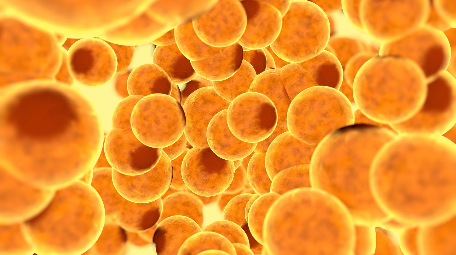 Bloated Fat Cells: Overflowing With Inflammation?